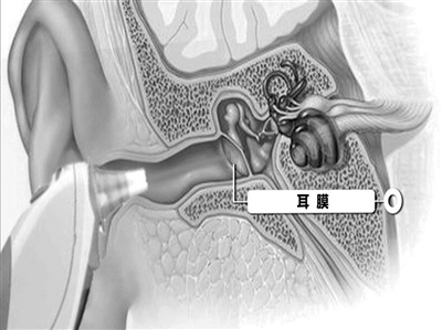 5岁儿童发烧用耳温枪量出38℃ 紧急送医量体温