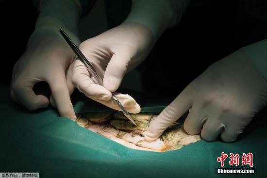 当地时间2017年3月6日,泰国曼谷,泰国朱拉隆功大学为海龟Omsin手术取出硬币。据悉,一只痛苦的海龟误吞了废弃池塘中许愿硬币,结果导致严重健康问题。