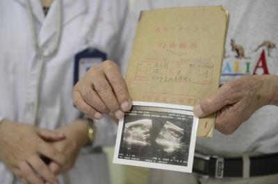 肖老1982年的老病历和当年B超结果